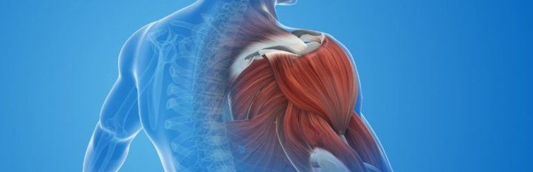 Cómo Aliviar El Dolor Muscular De Forma Natural: Rápido Y Fácil