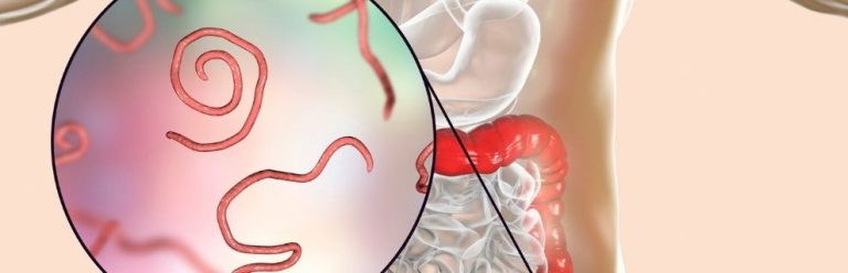 Elimina Gusanos Intestinales Con Ruda Y Semillas De Papaya